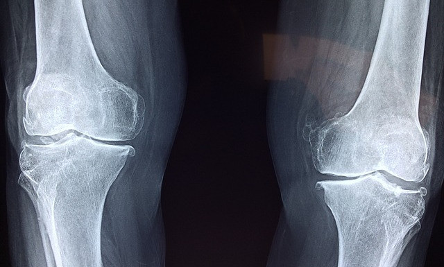 knee x-ray