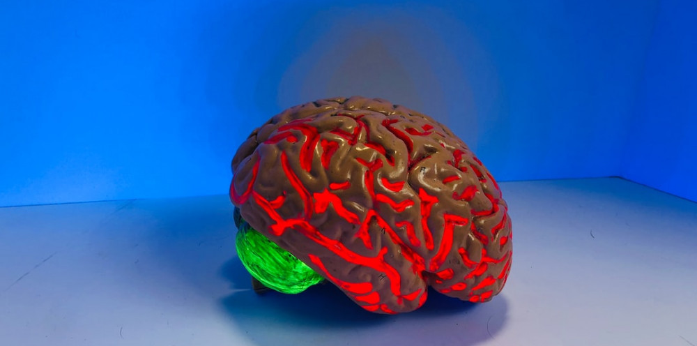 Image of a brain model overheated