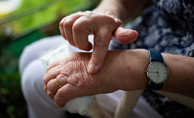 Image of woman hand with arthritis