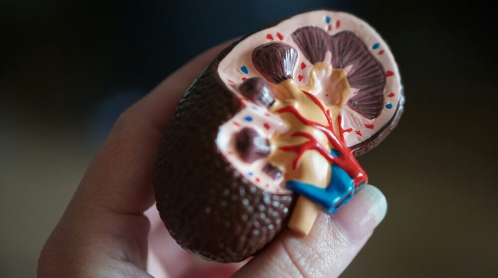 a model of a kidney